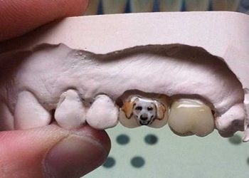 Dişte yeni trend: Diş dövmesi