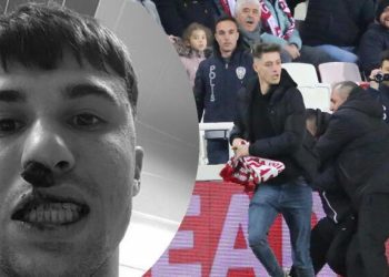 Sivas taraftarının burnunu kırdığı Bianco ameliyat olacak!