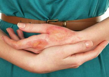 Yara izlerinin tamamen iyileşmesi mümkün müdür?