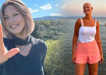 13 yaşında gittiği kuaför fark etti! ‘Saçlarım parça parça dökülmeye başladı’