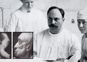 Türk asker yüzünü Çanakkale’de kaybetti! ‘Buruncu Joseph’ mucizeler yarattı