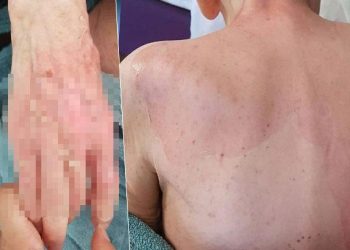 Huzurevinde ölüme götüren iddia! Beklenen rapor geldi